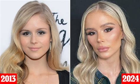 Plastic surgeon reveals procedures Erin Moriarty has had